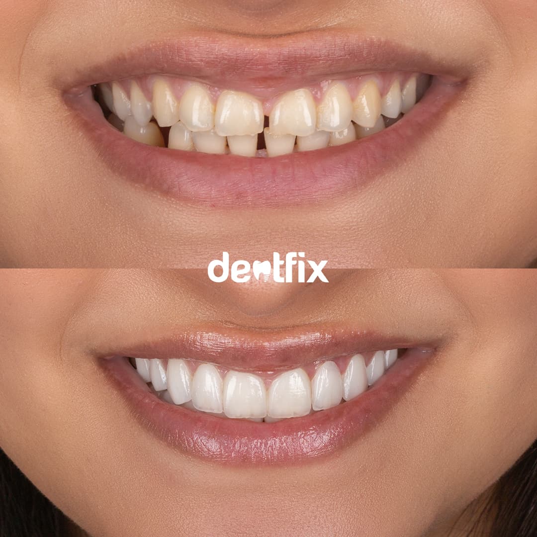 Before and after example