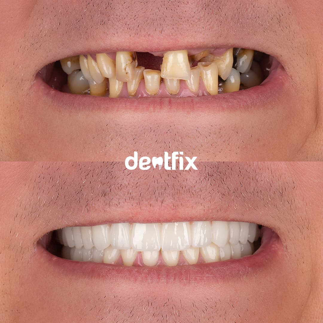 Before and after example