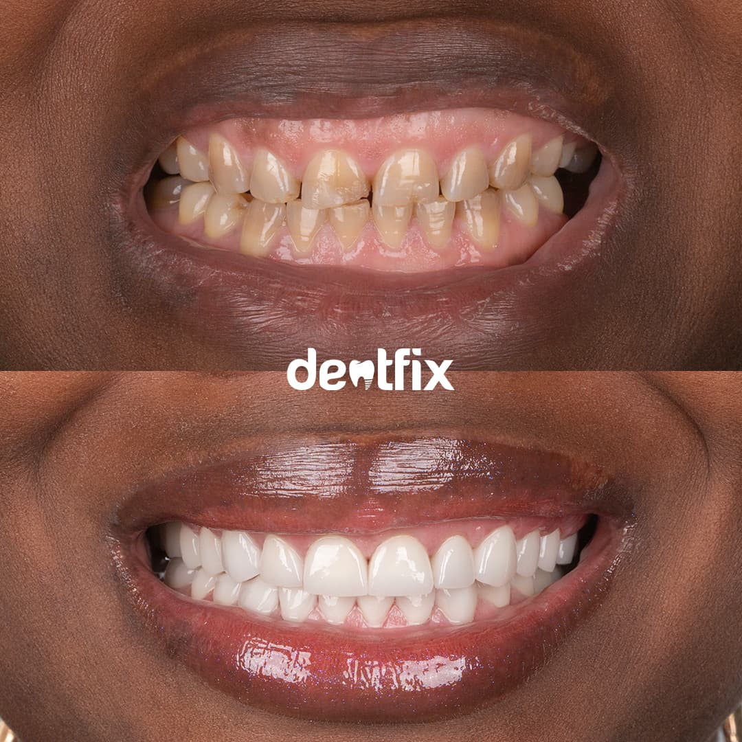 Before and after example