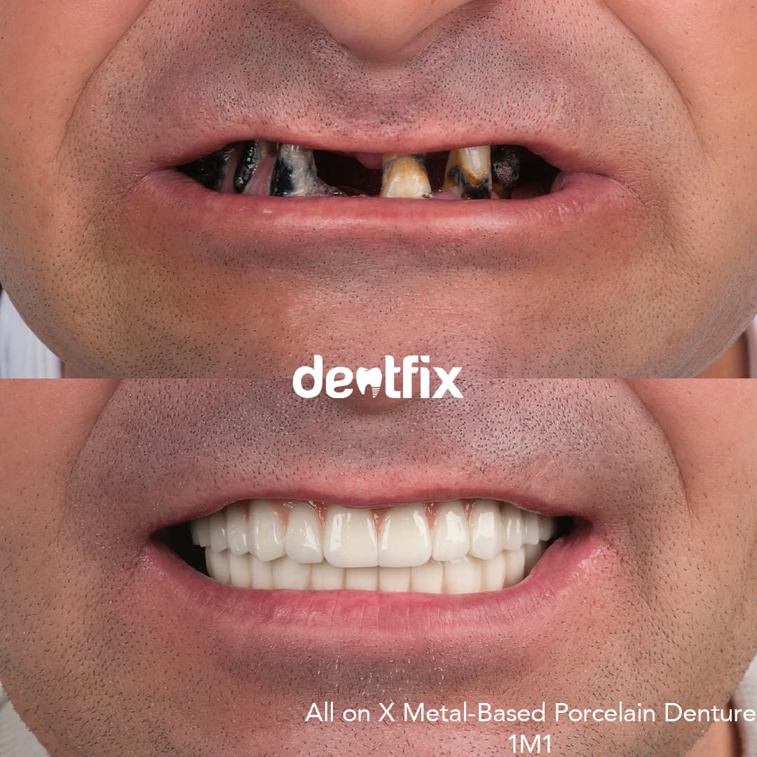 Before and after example