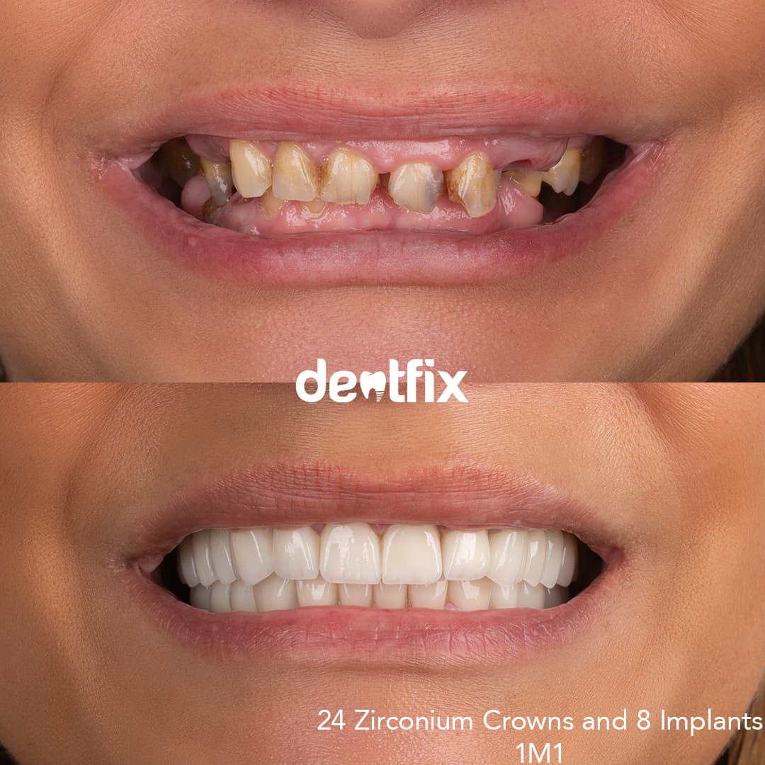 Before and after example