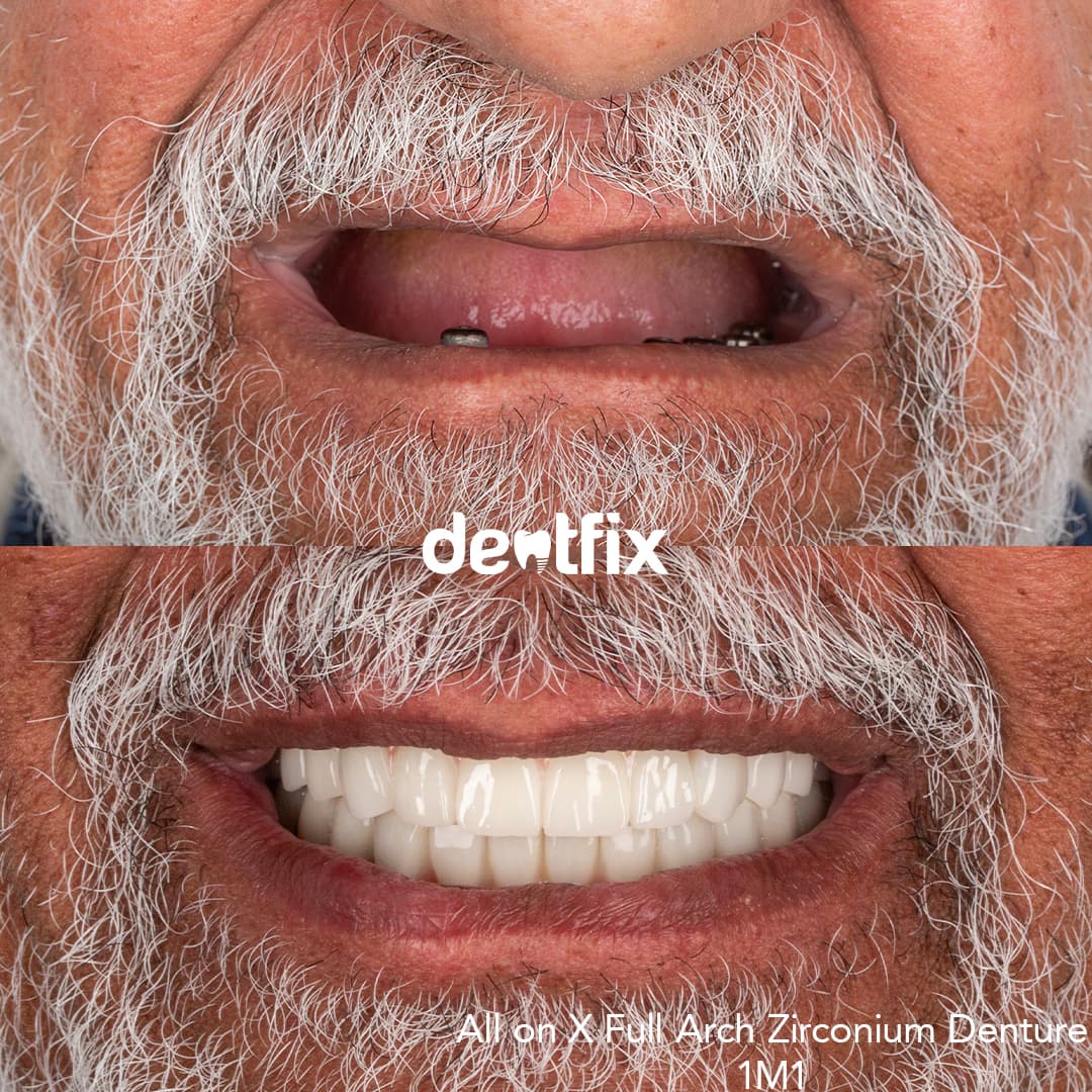 Before and after example